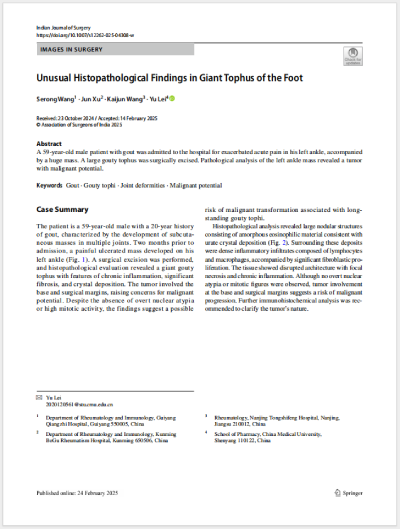 25����ɫ�����εȹ�ͬ׫��(xi��)�����¡�Unusual Histopathological Findings in Giant Tophus of the Foot�����㲿�޴�ʹ�L(f��ng)ʯ�Į����M������W(xu��)���F(xi��n)����SCI�ڿ���Indian Journal of Surgery���l(f��)����.png